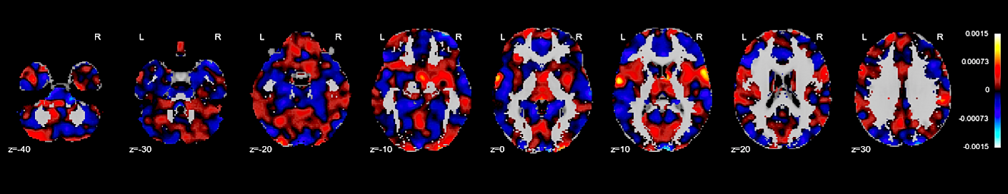 fmri_slices